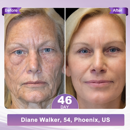🇺🇸FDA Official: 𝐇𝐈𝐒𝐊𝐈𝐍® 𝐏𝐃𝐑𝐍 𝐌𝐮𝐥𝐭𝐢-𝐏𝐞𝐩𝐭𝐢𝐝𝐞 𝐌𝐚𝐬𝐬𝐚𝐠𝐢𝐧𝐠 𝐁𝐨𝐝𝐲 𝐑𝐨𝐥𝐥𝐞𝐫 𝐂𝐫𝐞𝐚𝐦- Anti-aging, Hydrating, Skin Firming & Lifting, Skin Repair, Even Tone, Acne and Dark Spot Treatment, Wart and Mole Removal, and Psoriasis Relief.