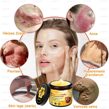 💐🌟💐Made and Shipped from USA ✨ VLSVLS® Bee Venom Skin Restoration Cream 🔥 LAST DAY 80% OFF