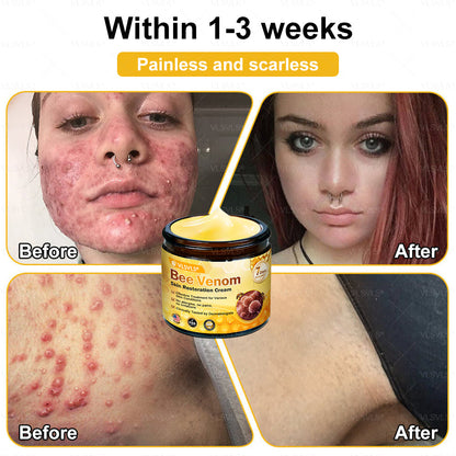 💐💟💐Made and Shipped from US ✨ VLSVLS® Bee Venom Skin Restoration Cream 🔥 LAST DAY 80% OFF