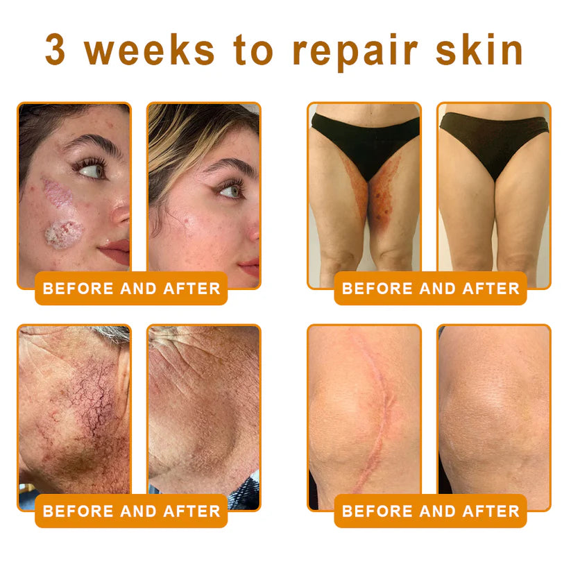💐✨💐Made and Shipped from US ✨ VLSVLS® Bee Venom Skin Restoration Cream 🔥 💧 Targets wrinkles, fine lines, purpura, sagging, stretch marks, dark spots—firming, lifting and more