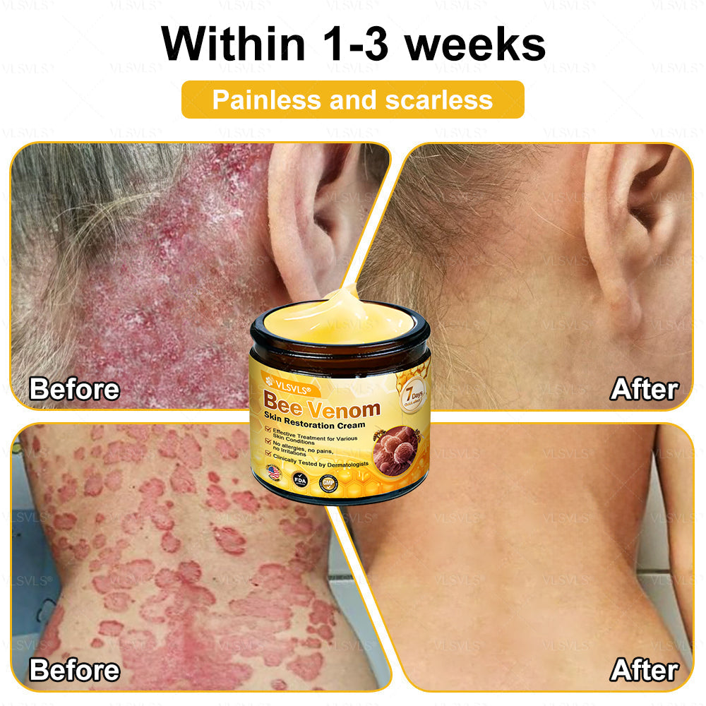 💐💟💐Made and Shipped from US ✨ VLSVLS® Bee Venom Skin Restoration Cream 🔥 LAST DAY 80% OFF
