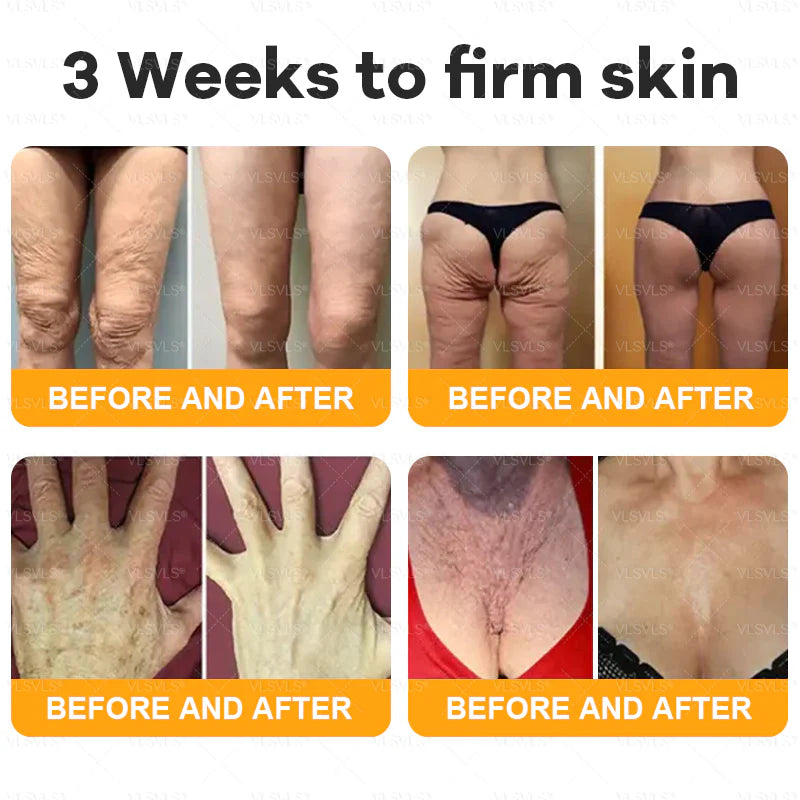 💐✨💐Made and Shipped from US ✨ VLSVLS® Bee Venom Skin Restoration Cream 🔥 💧 Targets wrinkles, fine lines, purpura, sagging, stretch marks, dark spots—firming, lifting and more