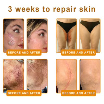💐🇺🇸💐Made and Shipped from US ✨ VLSVLS® Bee Venom Skin Restoration Cream 🔥 LAST DAY 80% OFF