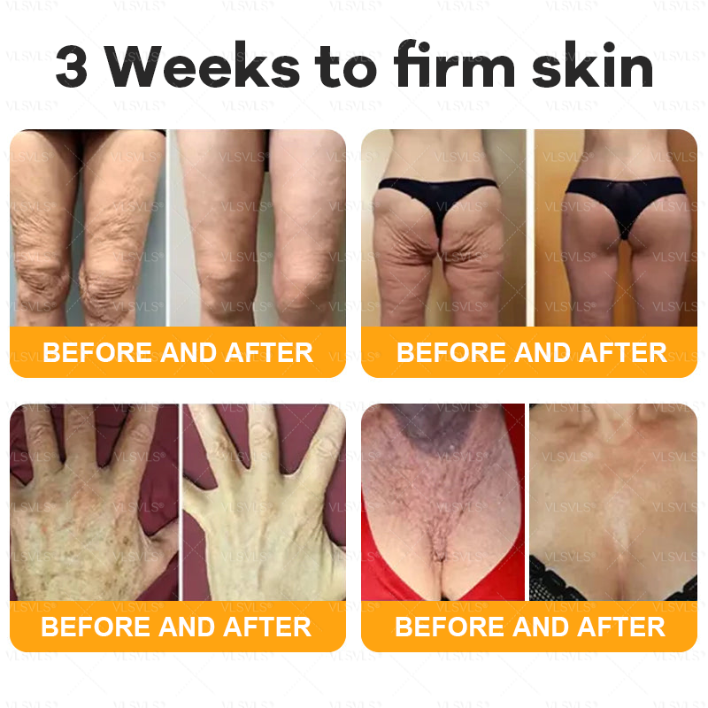 💐🌟💐Made and Shipped from USA ✨ VLSVLS® Bee Venom Skin Restoration Cream 🔥 LAST DAY 80% OFF