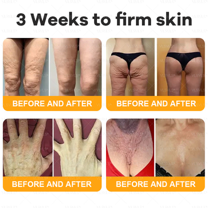 💐🌟💐Made and Shipped from USA ✨ VLSVLS® Bee Venom Skin Restoration Cream 🔥 LAST DAY 80% OFF