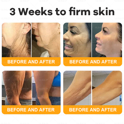 💐🌟💐Made and Shipped from USA ✨ VLSVLS® Bee Venom Skin Restoration Cream 🔥 LAST DAY 80% OFF