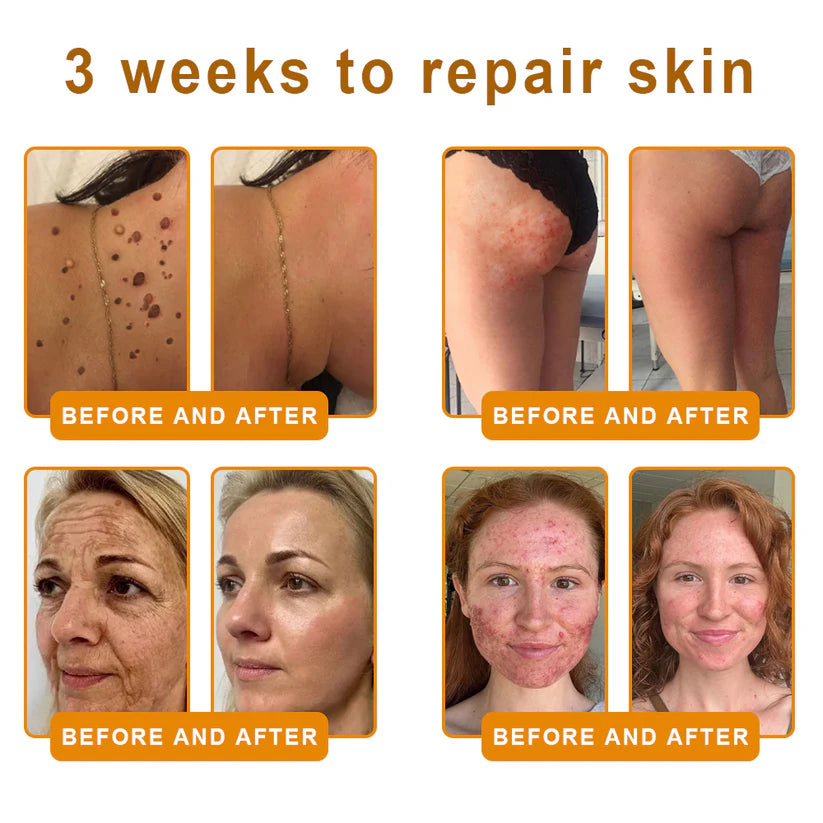 💐✨💐Made and Shipped from US ✨ VLSVLS® Bee Venom Skin Restoration Cream 🔥 💧 Targets wrinkles, fine lines, purpura, sagging, stretch marks, dark spots—firming, lifting and more