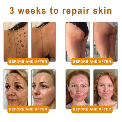 💐✨💐Made and Shipped from US ✨ VLSVLS® Bee Venom Skin Restoration Cream 🔥 💧 Targets wrinkles, fine lines, purpura, sagging, stretch marks, dark spots—firming, lifting and more