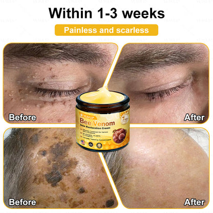 💐💟💐Made and Shipped from US ✨ VLSVLS® Bee Venom Skin Restoration Cream 🔥 LAST DAY 80% OFF