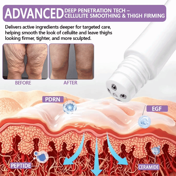 🇺🇸FDA Official: 𝐇𝐈𝐒𝐊𝐈𝐍® 𝐏𝐃𝐑𝐍 𝐌𝐮𝐥𝐭𝐢-𝐏𝐞𝐩𝐭𝐢𝐝𝐞 𝐌𝐚𝐬𝐬𝐚𝐠𝐢𝐧𝐠 𝐁𝐨𝐝𝐲 𝐑𝐨𝐥𝐥𝐞𝐫 𝐂𝐫𝐞𝐚𝐦- Anti-aging, Hydrating, Skin Firming & Lifting, Skin Repair, Even Tone, Acne and Dark Spot Treatment, Wart and Mole Removal, and Psoriasis Relief.