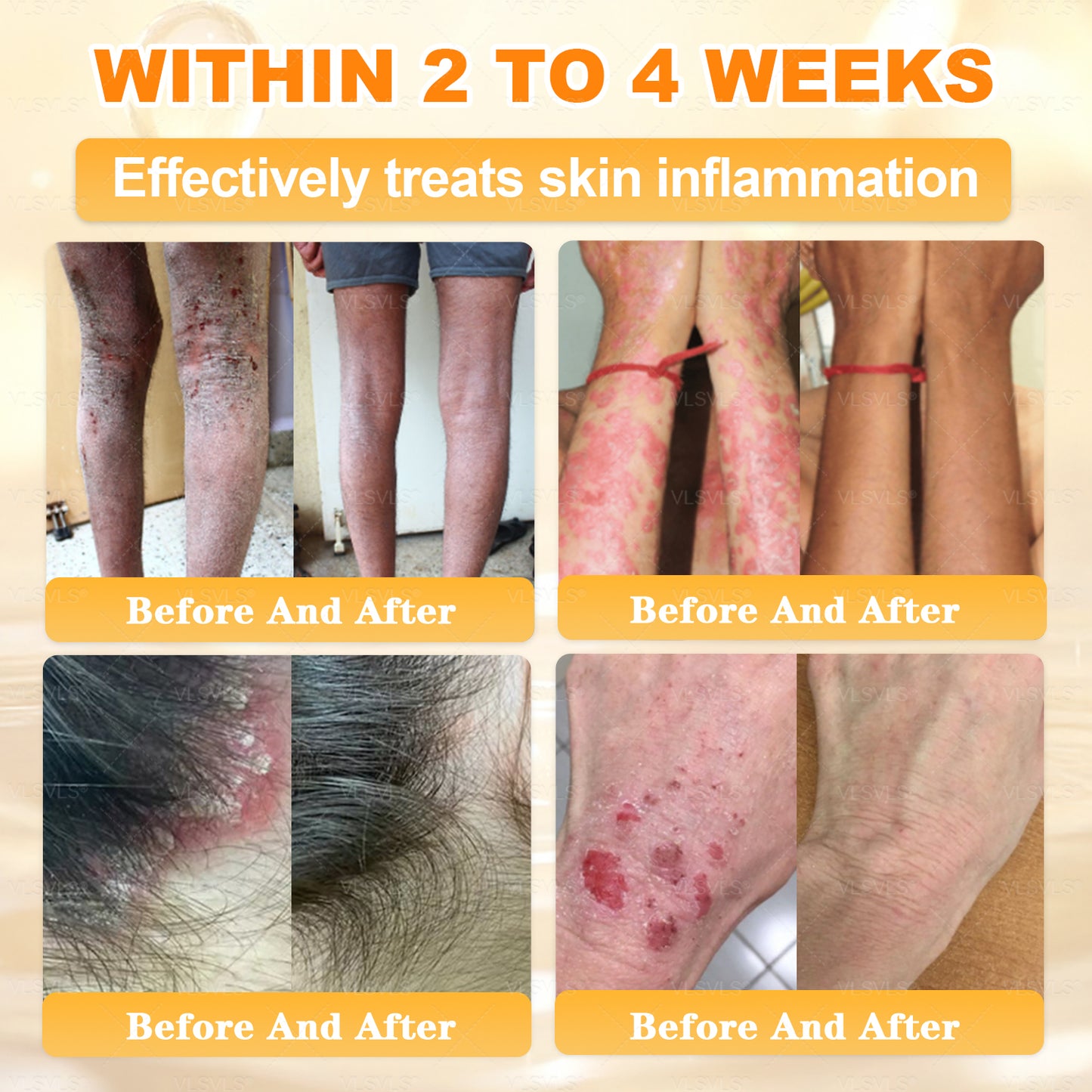 💐🌟💐Made and Shipped from USA ✨ VLSVLS® Bee Venom Skin Restoration Cream 🔥 LAST DAY 80% OFF