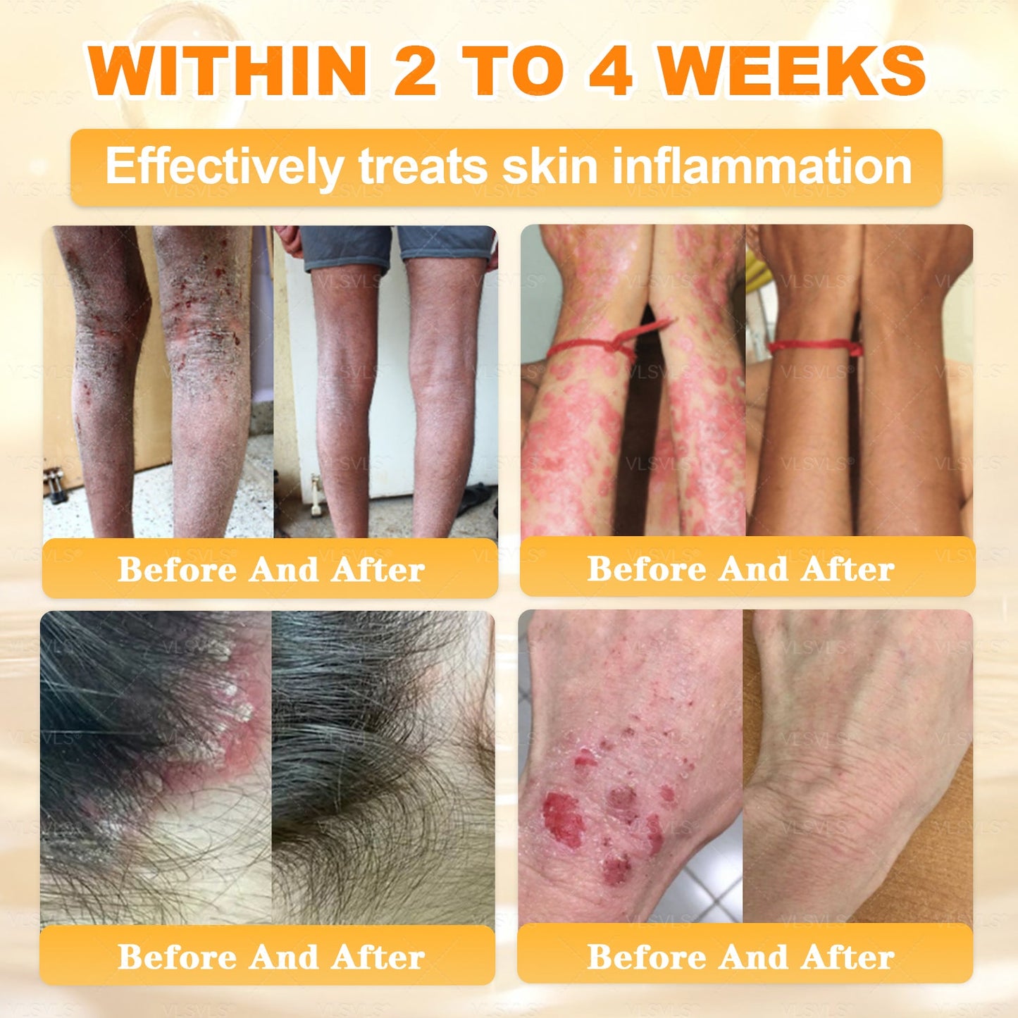 💐💟💐Made and Shipped from US ✨ VLSVLS® Bee Venom Skin Restoration Cream 🔥 LAST DAY 80% OFF