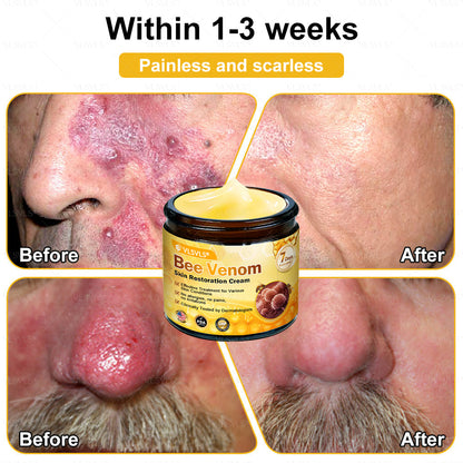 💐💟💐Made and Shipped from US ✨ VLSVLS® Bee Venom Skin Restoration Cream 🔥 LAST DAY 80% OFF