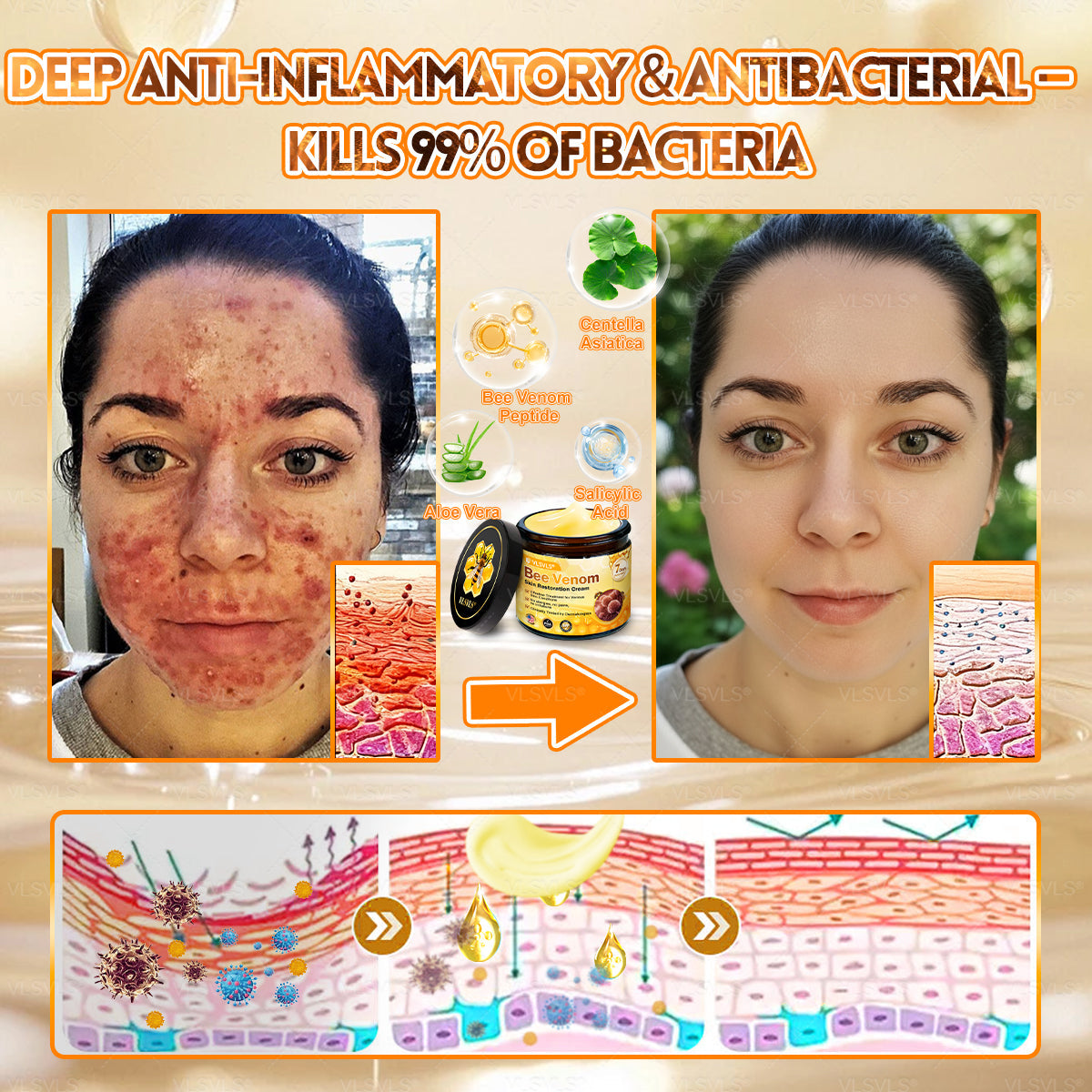 💐💟💐Made and Shipped from US ✨ VLSVLS® Bee Venom Skin Restoration Cream 🔥 LAST DAY 80% OFF