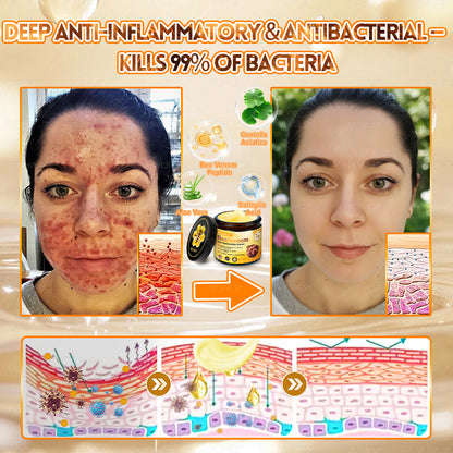💐💟💐Made and Shipped from US ✨ VLSVLS® Bee Venom Skin Restoration Cream 🔥 LAST DAY 80% OFF