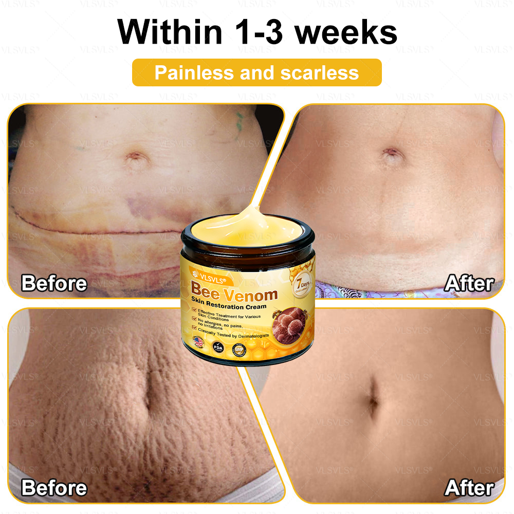 💐💟💐Made and Shipped from US ✨ VLSVLS® Bee Venom Skin Restoration Cream 🔥 LAST DAY 80% OFF