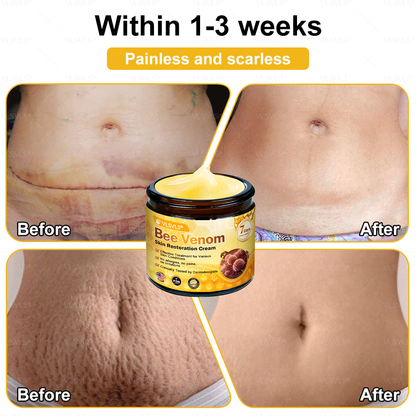 💐💟💐Made and Shipped from US ✨ VLSVLS® Bee Venom Skin Restoration Cream 🔥 LAST DAY 80% OFF