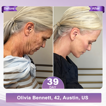 🇺🇸FDA Official: 𝐇𝐈𝐒𝐊𝐈𝐍® 𝐏𝐃𝐑𝐍 𝐌𝐮𝐥𝐭𝐢-𝐏𝐞𝐩𝐭𝐢𝐝𝐞 𝐌𝐚𝐬𝐬𝐚𝐠𝐢𝐧𝐠 𝐁𝐨𝐝𝐲 𝐑𝐨𝐥𝐥𝐞𝐫 𝐂𝐫𝐞𝐚𝐦- Anti-aging, Hydrating, Skin Firming & Lifting, Skin Repair, Even Tone, Acne and Dark Spot Treatment, Wart and Mole Removal, and Psoriasis Relief.