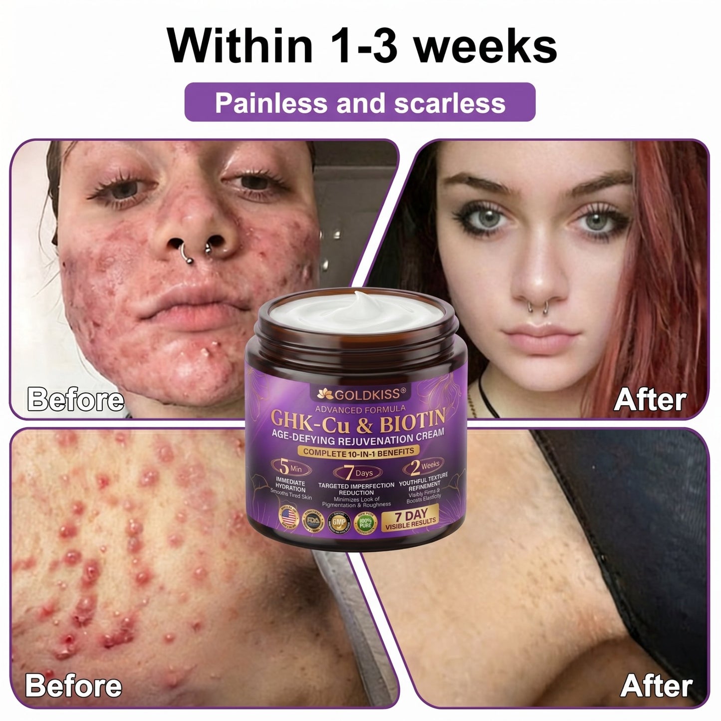 Made and Shipped from USA✨ 𝐆𝐎𝐋𝐃𝐊𝐈𝐒𝐒® 𝐆𝐇𝐊-𝐂𝐮 & 𝐁𝐈𝐎𝐓𝐈𝐍 𝟏𝟎-𝐈𝐍-𝟏 𝐒𝐤𝐢𝐧 𝐑𝐞𝐬𝐭𝐨𝐫𝐚𝐭𝐢𝐨𝐧 𝐂𝐫𝐞𝐚𝐦 ⚡