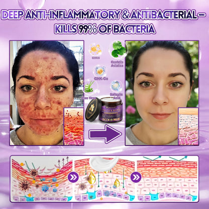 Made and Shipped from USA✨ 𝐆𝐎𝐋𝐃𝐊𝐈𝐒𝐒® 𝐆𝐇𝐊-𝐂𝐮 & 𝐁𝐈𝐎𝐓𝐈𝐍 𝟏𝟎-𝐈𝐍-𝟏 𝐒𝐤𝐢𝐧 𝐑𝐞𝐬𝐭𝐨𝐫𝐚𝐭𝐢𝐨𝐧 𝐂𝐫𝐞𝐚𝐦 ⚡